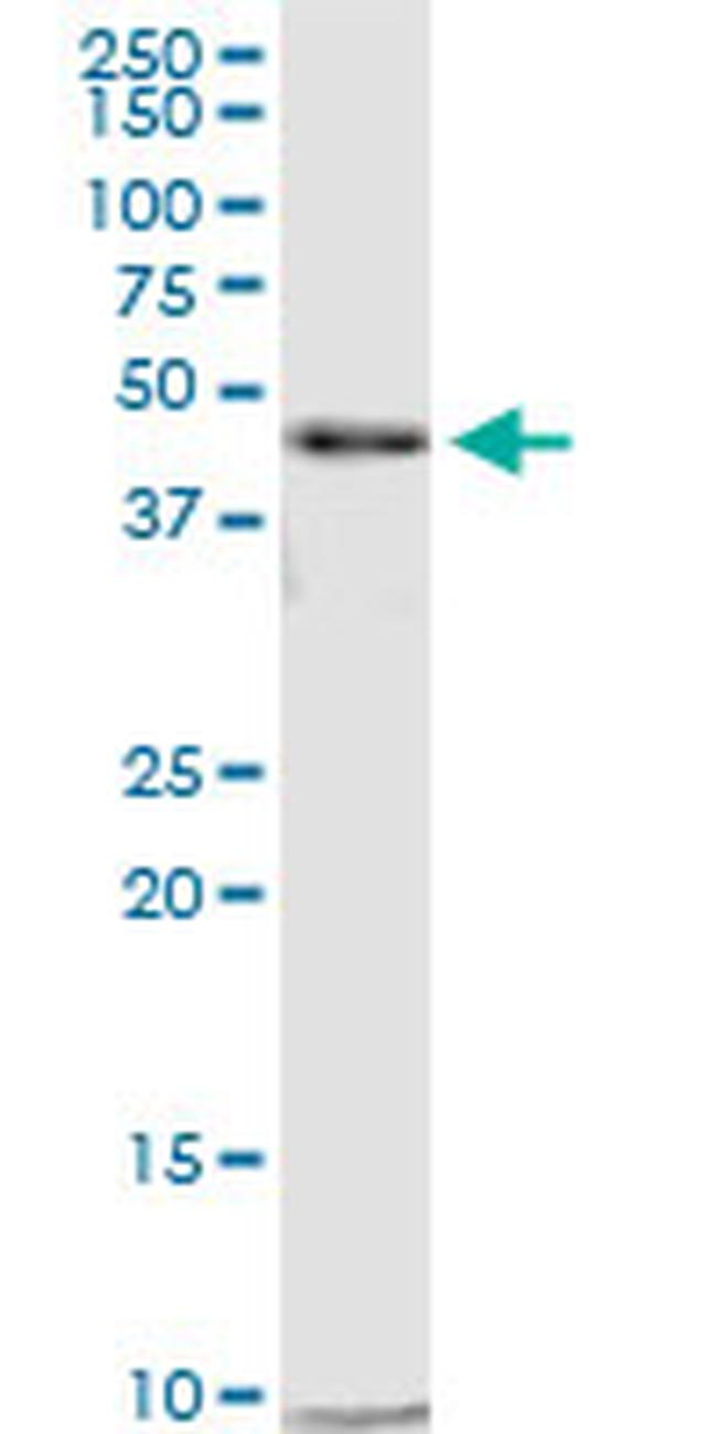 CTBP2 Antibody in Western Blot (WB)
