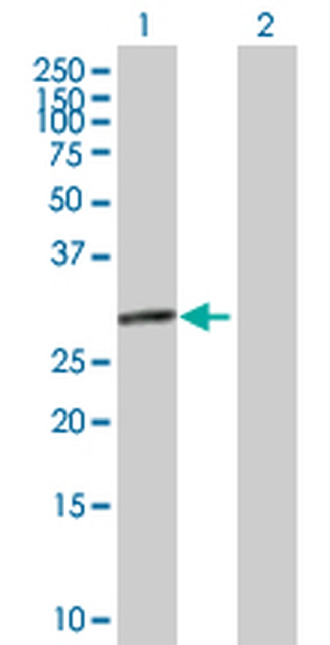 EIF2B1 Antibody in Western Blot (WB)