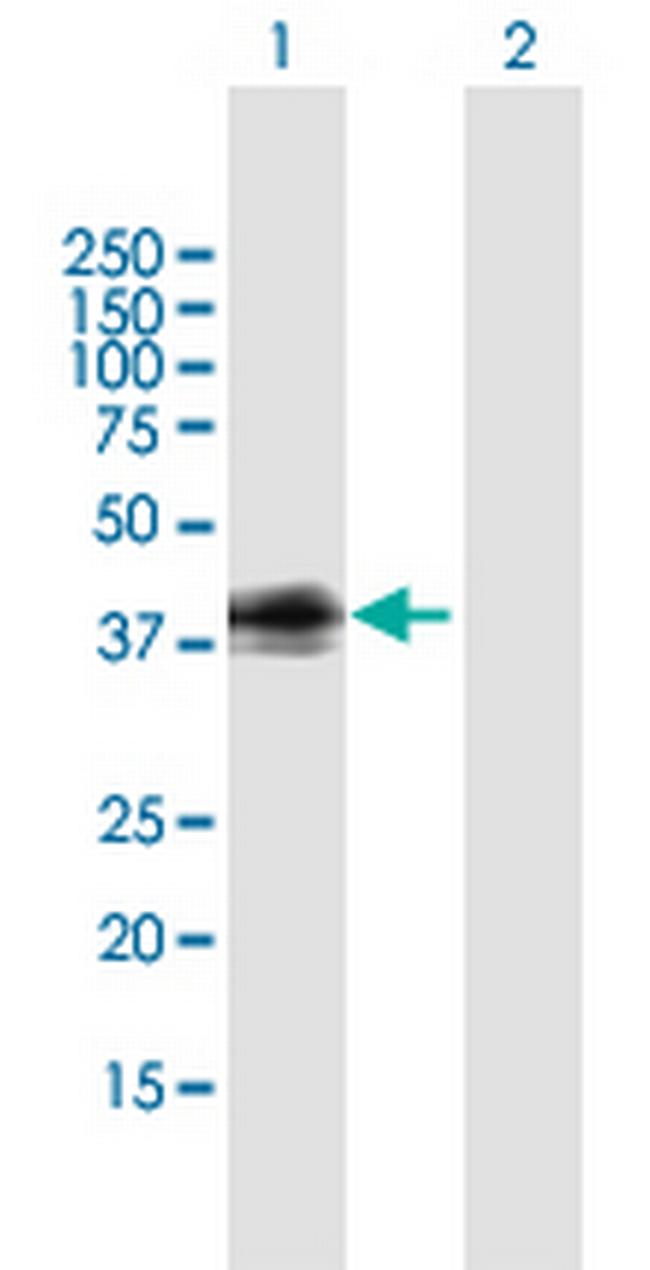 GPR1 Antibody in Western Blot (WB)
