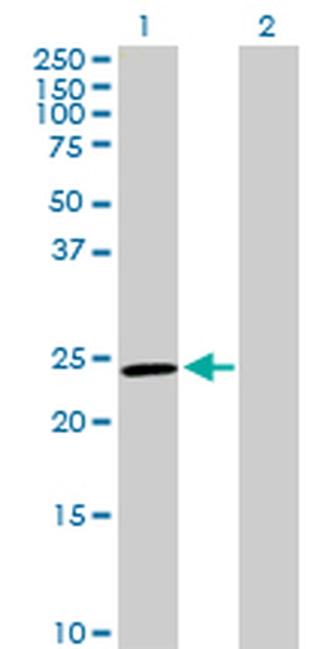 GSTM5 Antibody in Western Blot (WB)