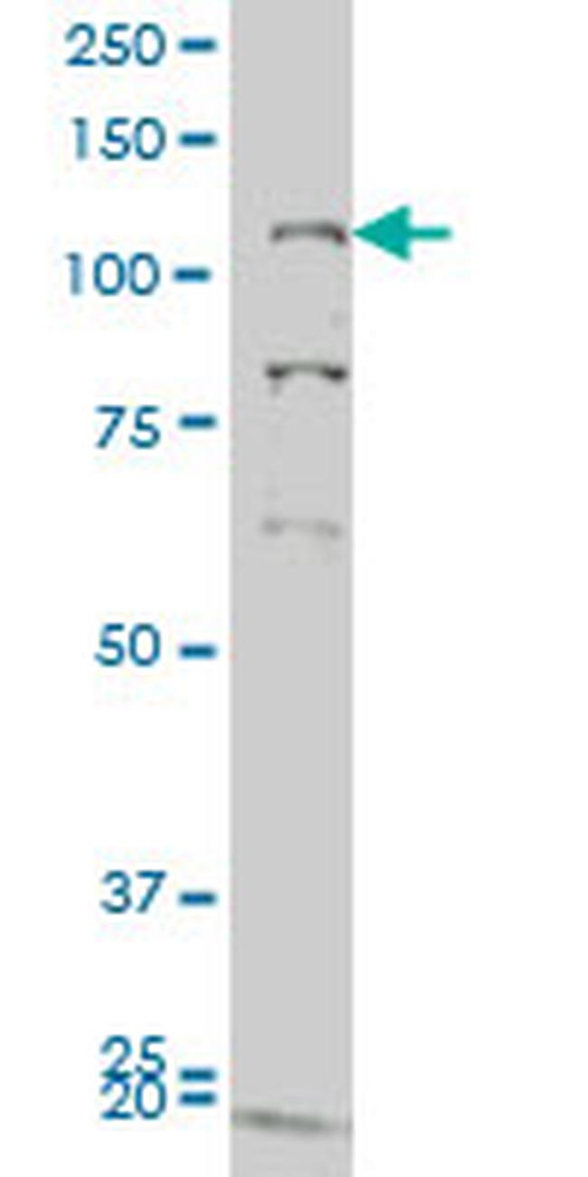 GUCY2C Antibody in Western Blot (WB)