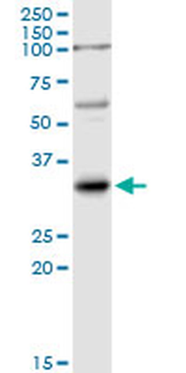 IL1B Antibody in Western Blot (WB)