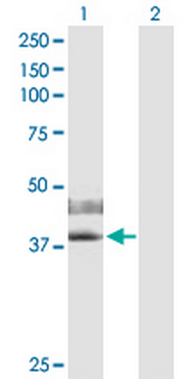 IL2RG Antibody in Western Blot (WB)