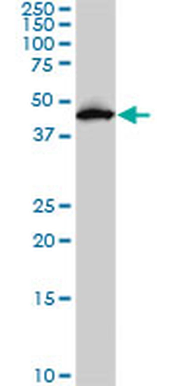 PDK2 Antibody in Western Blot (WB)