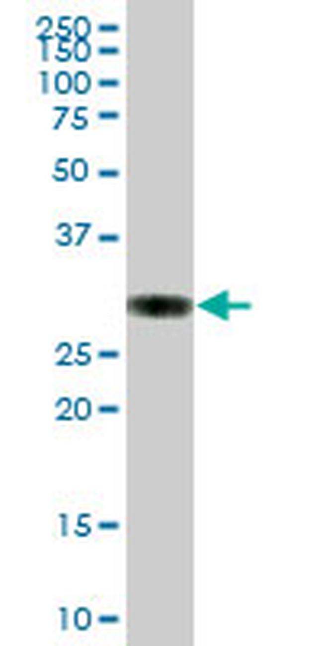 PPT1 Antibody in Western Blot (WB)