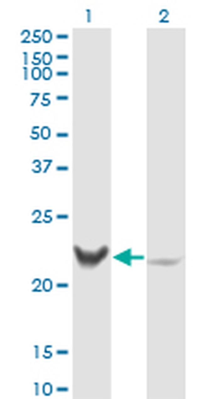 RCV1 Antibody in Western Blot (WB)