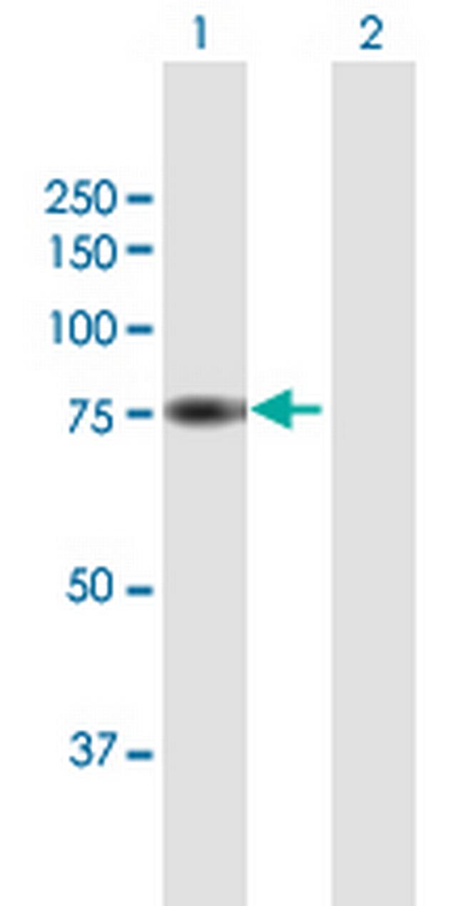 RFX5 Antibody in Western Blot (WB)