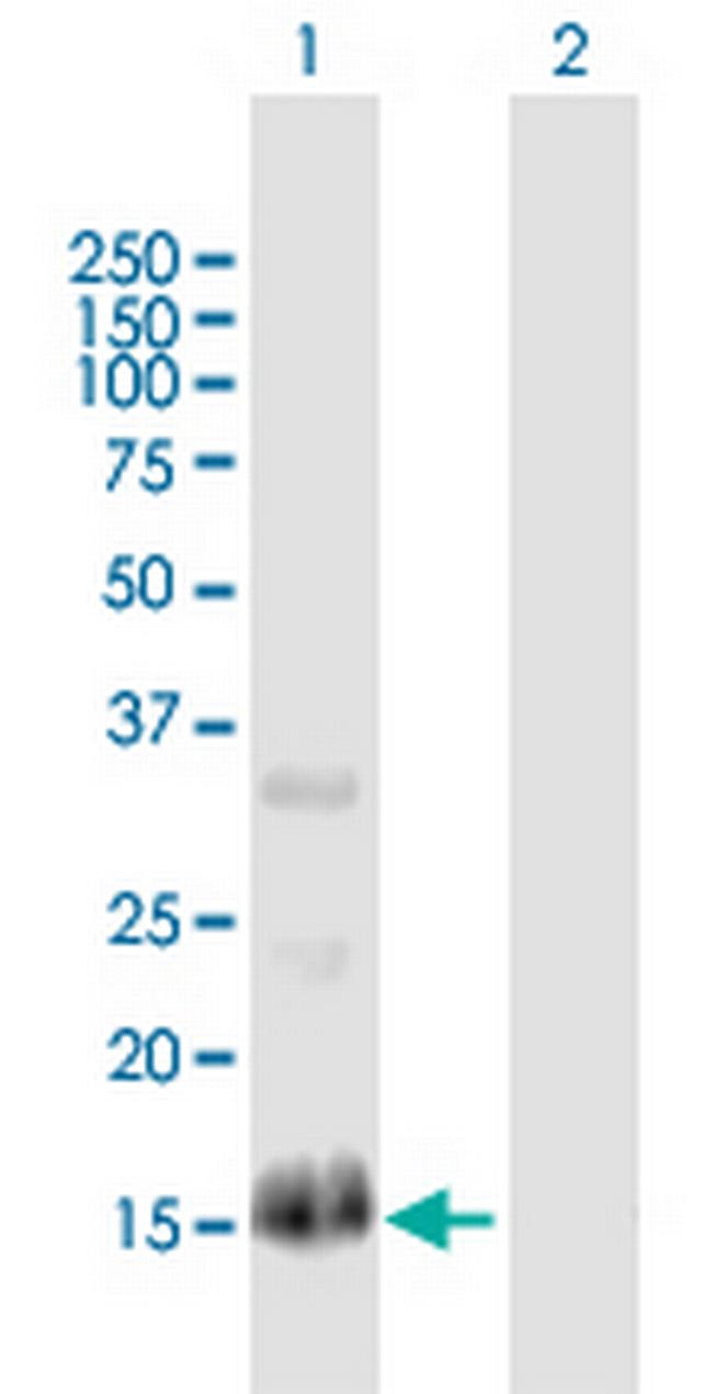 RGS13 Antibody in Western Blot (WB)