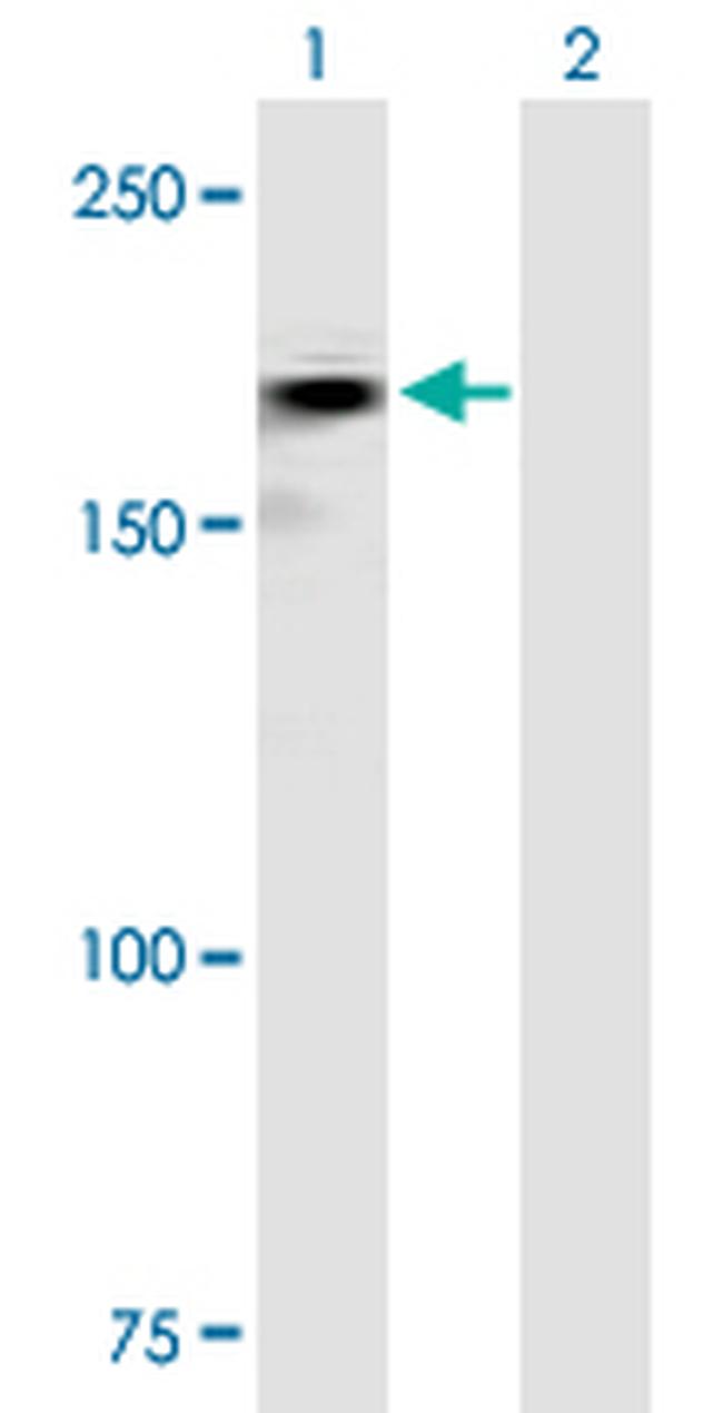 ROBO2 Antibody in Western Blot (WB)