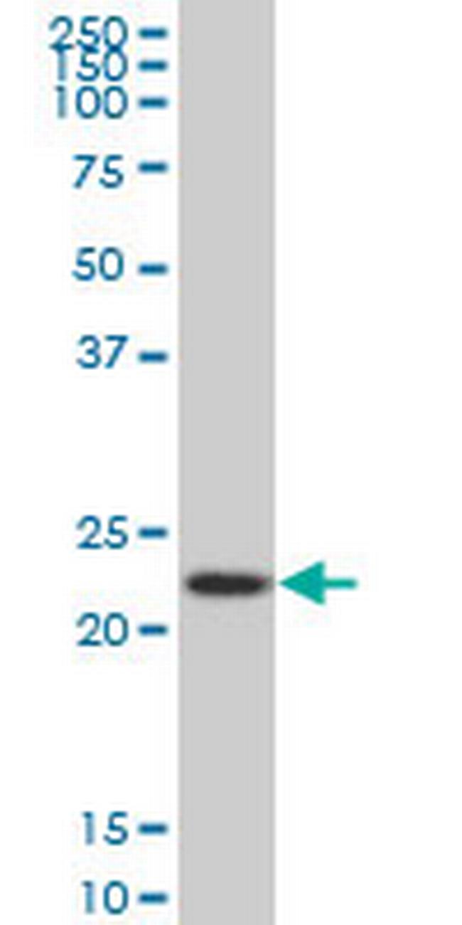 RPS5 Antibody in Western Blot (WB)