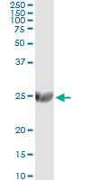 ST6GAL1 Antibody in Immunoprecipitation (IP)