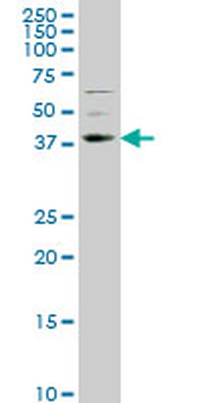 NR2E1 Antibody in Western Blot (WB)