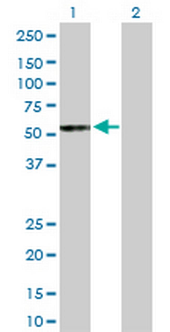 UGT2B15 Antibody in Western Blot (WB)
