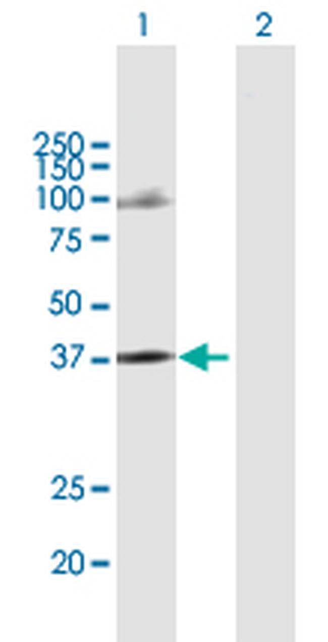 CCRL2 Antibody in Western Blot (WB)