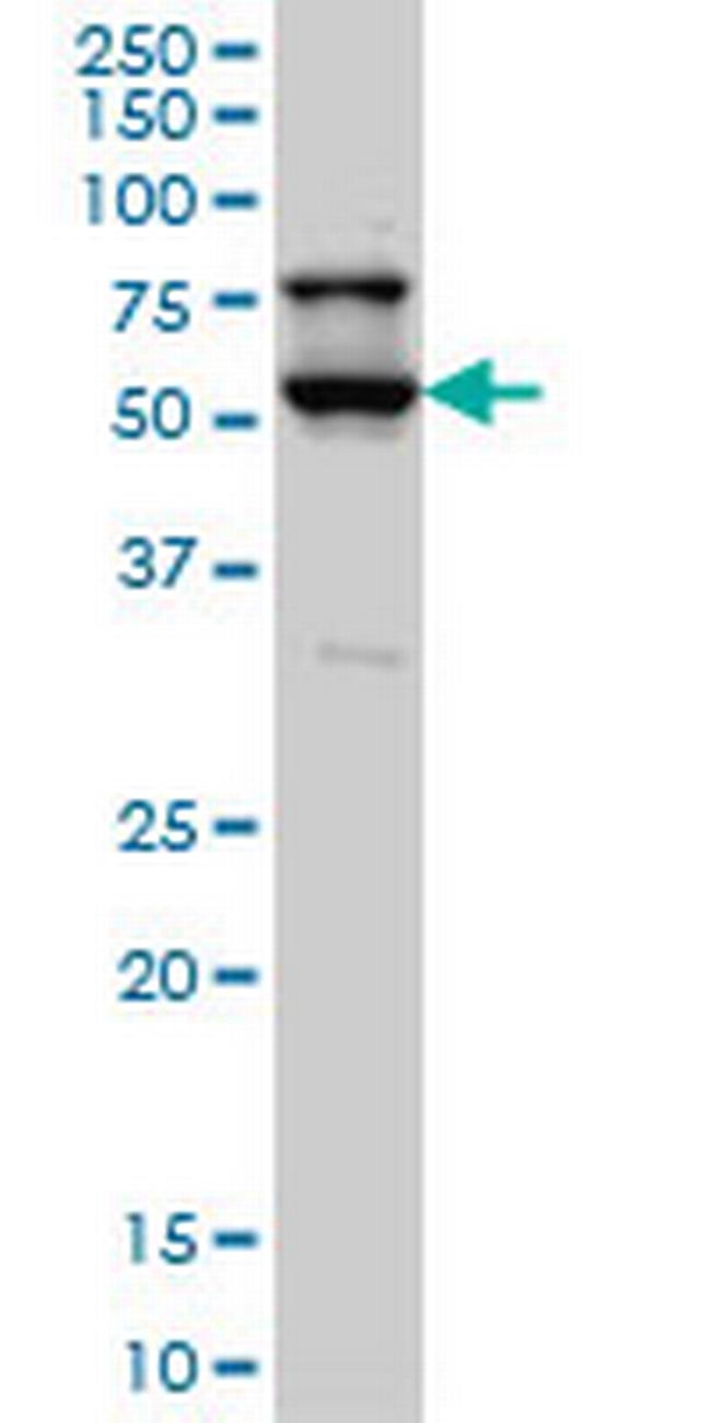 STK17A Antibody in Western Blot (WB)