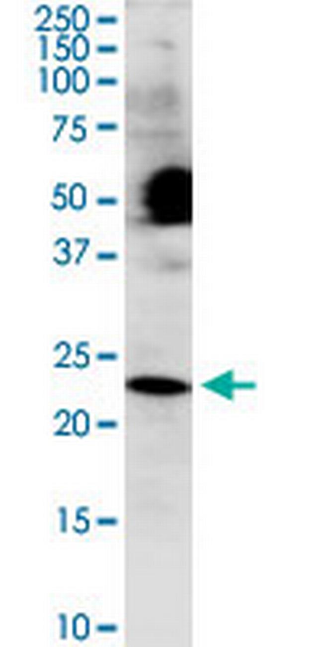 COX4NB Antibody in Western Blot (WB)