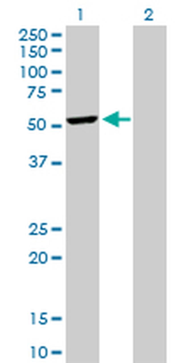 DCTN2 Antibody in Western Blot (WB)