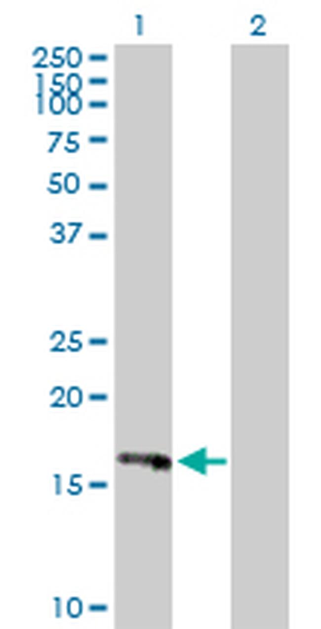 HRASLS3 Antibody in Western Blot (WB)