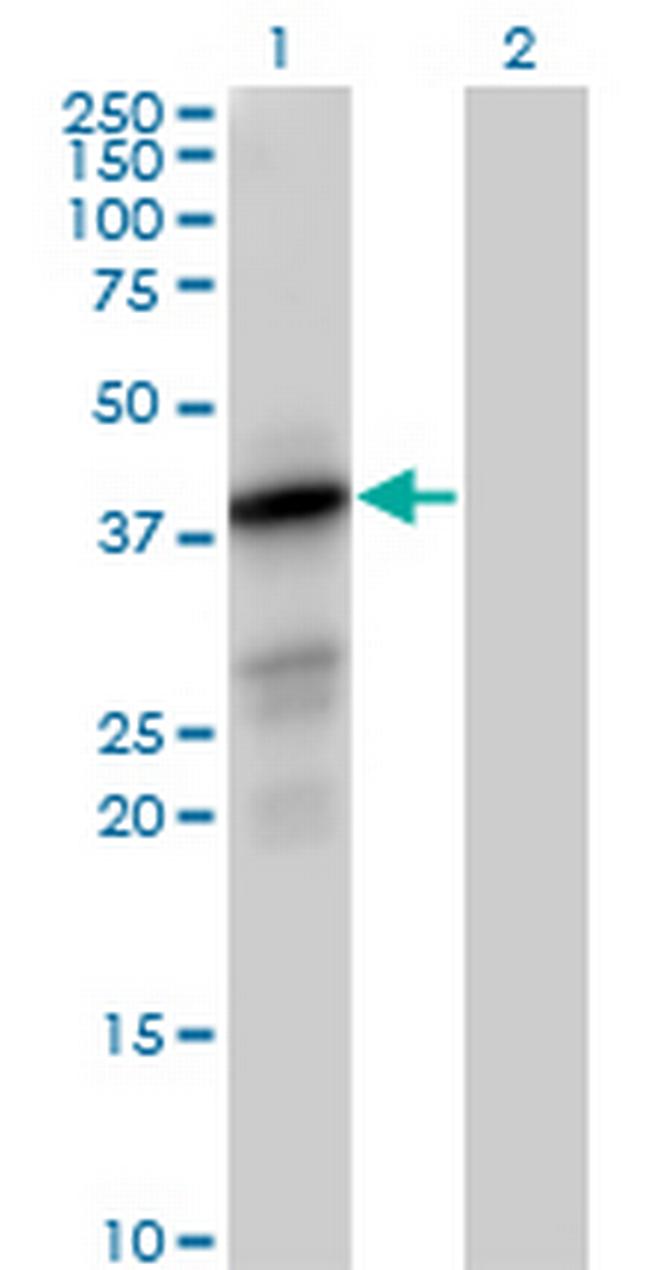 PTPLAD1 Antibody in Western Blot (WB)