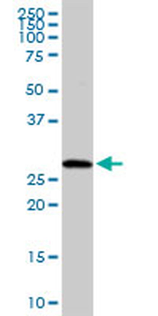 RAB23 Antibody in Western Blot (WB)