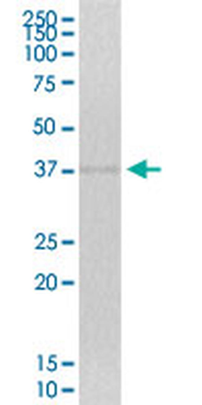ZNF444 Antibody in Western Blot (WB)