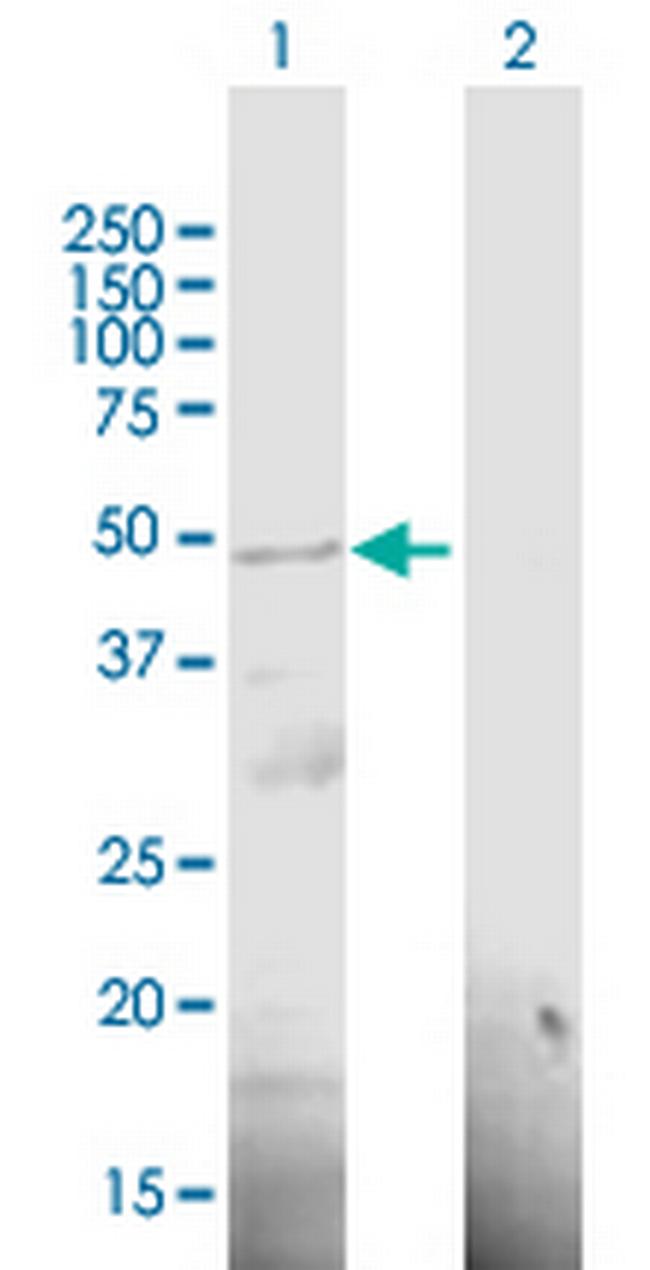 RP11-98F14.6 Antibody in Western Blot (WB)