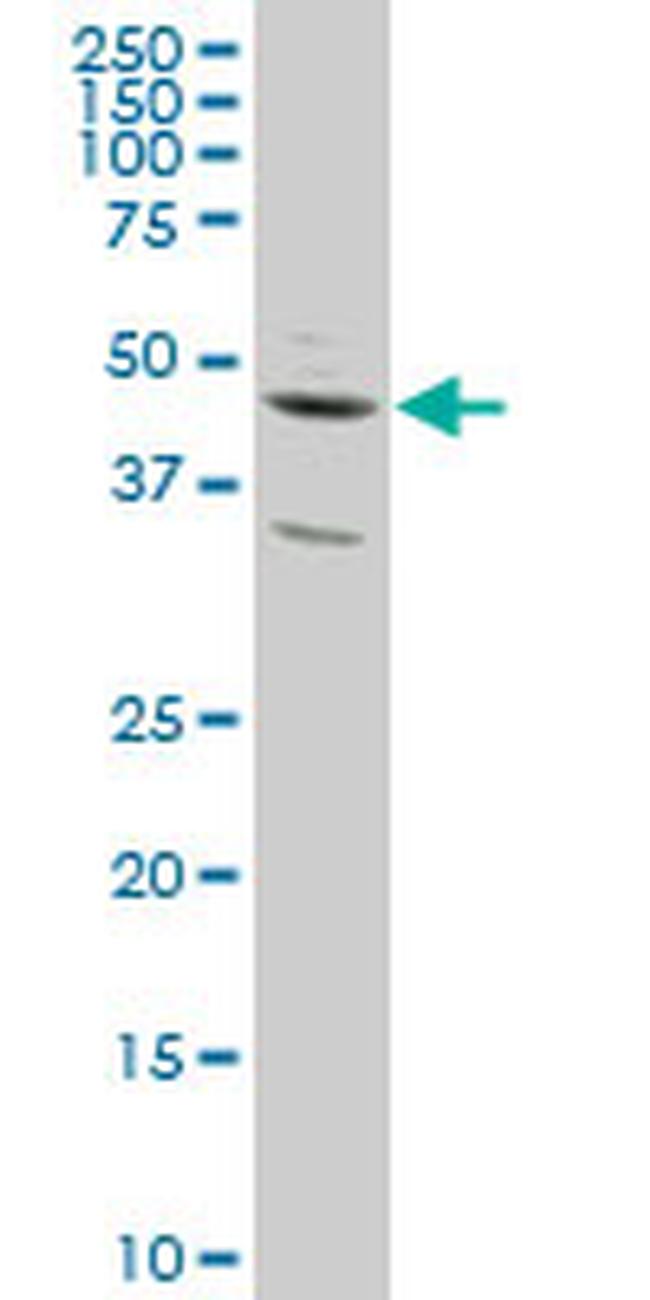 SLC2A4RG Antibody in Western Blot (WB)