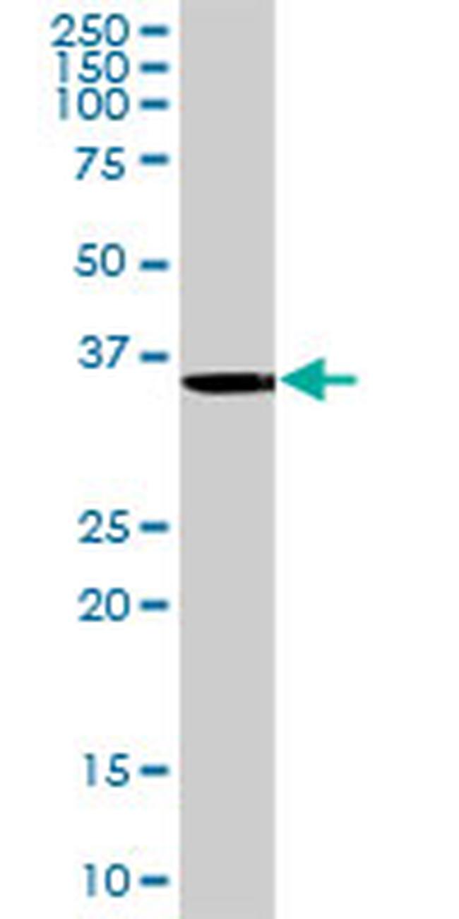 ANKRA2 Antibody in Western Blot (WB)