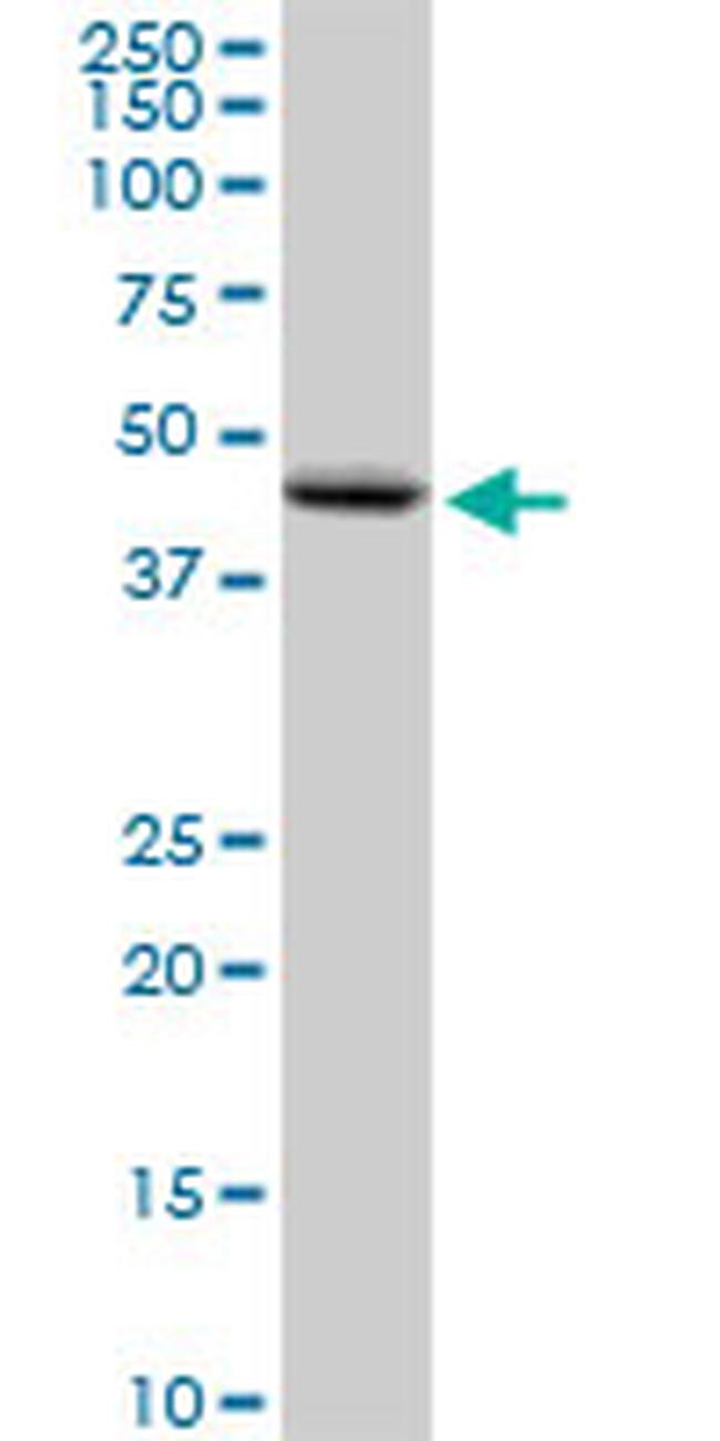 PNPLA3 Antibody in Western Blot (WB)