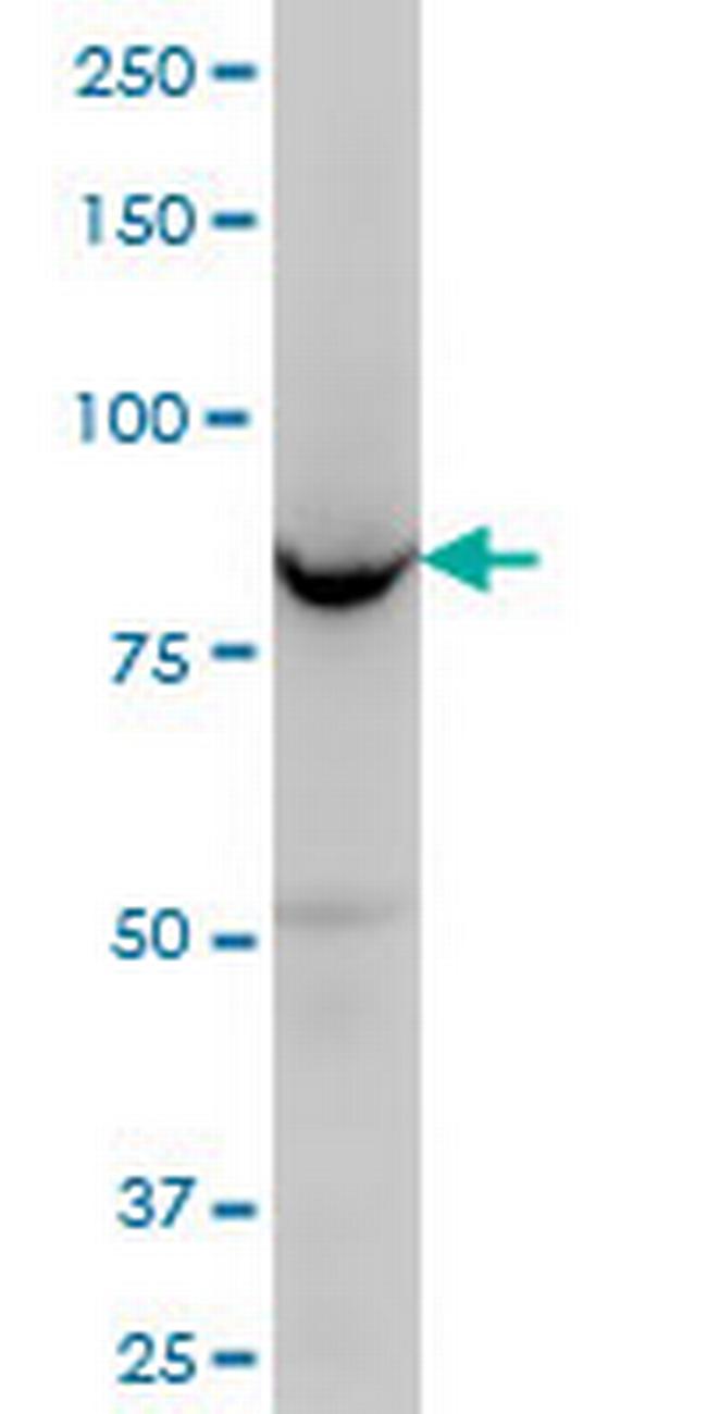 OSBPL8 Antibody in Western Blot (WB)