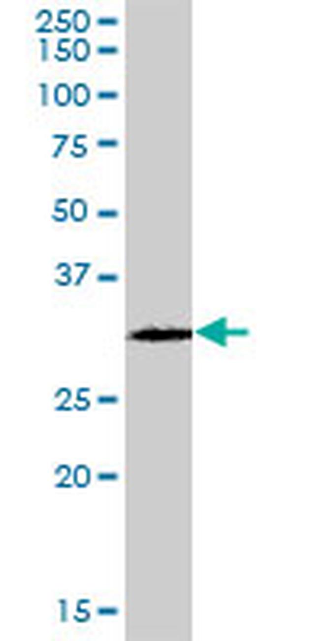 GSTO2 Antibody in Western Blot (WB)