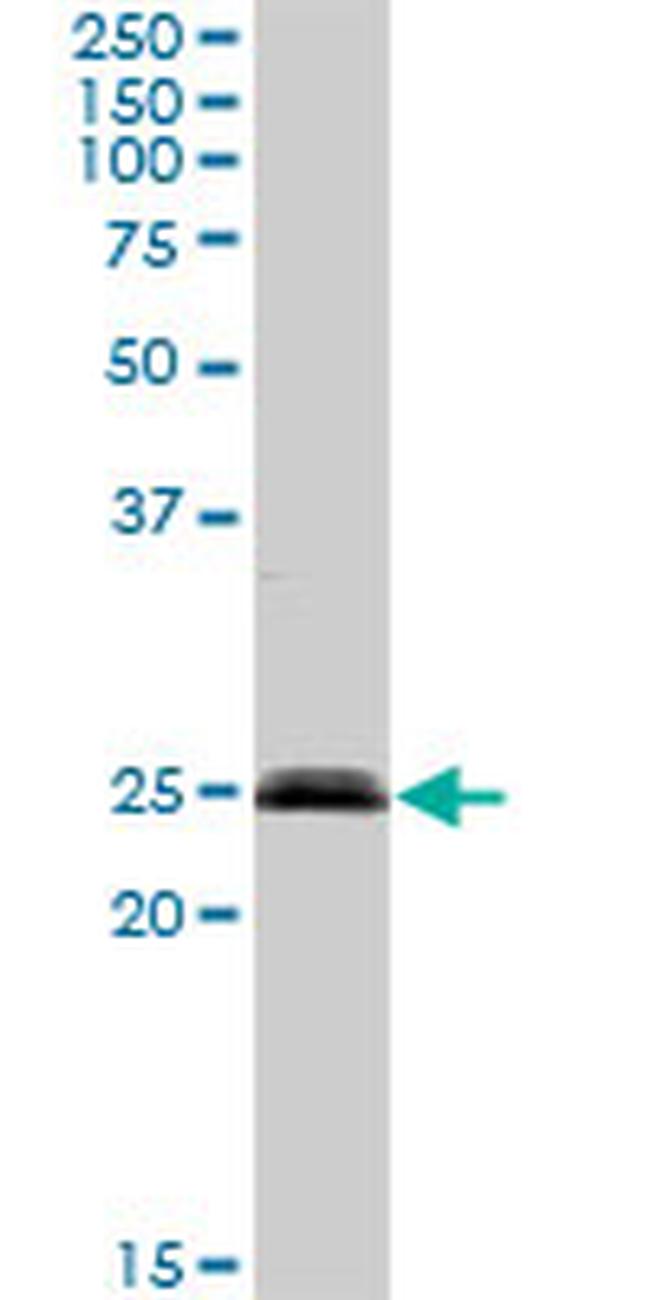 SENP8 Antibody in Western Blot (WB)
