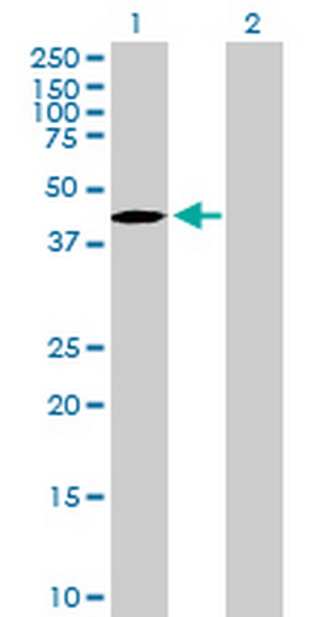 TBC1D20 Antibody in Western Blot (WB)