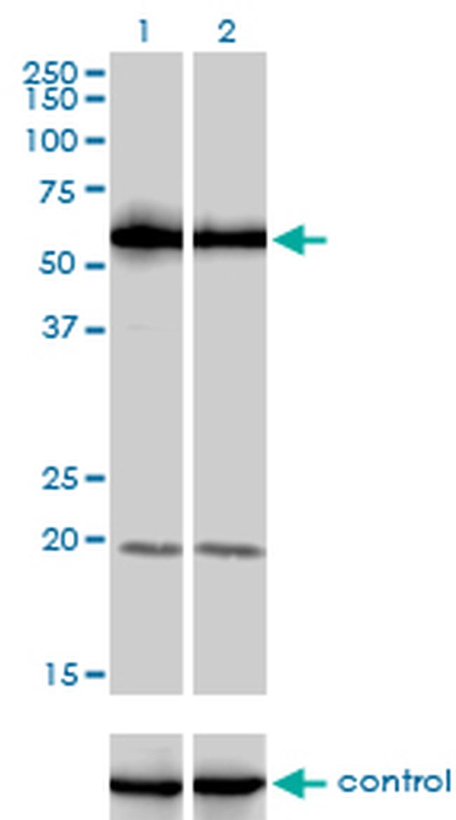 PIP5K3 Antibody in Western Blot (WB)