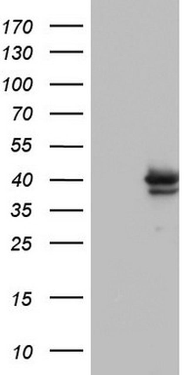 H2AFY2 Antibody in Western Blot (WB)
