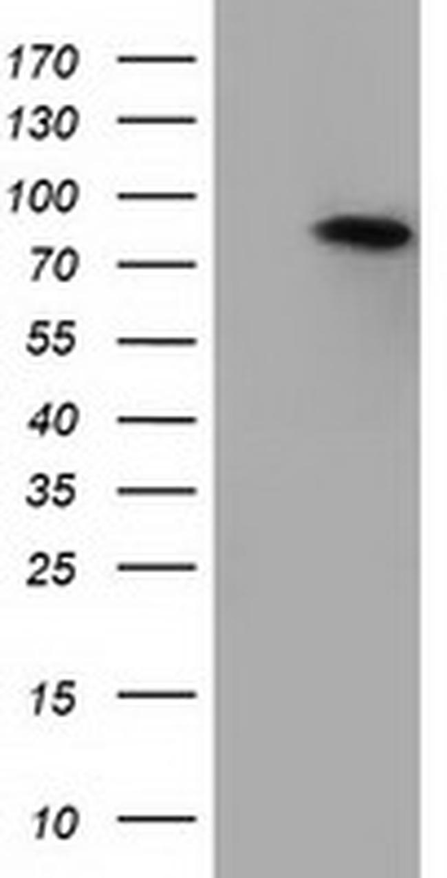 H6PD Antibody in Western Blot (WB)
