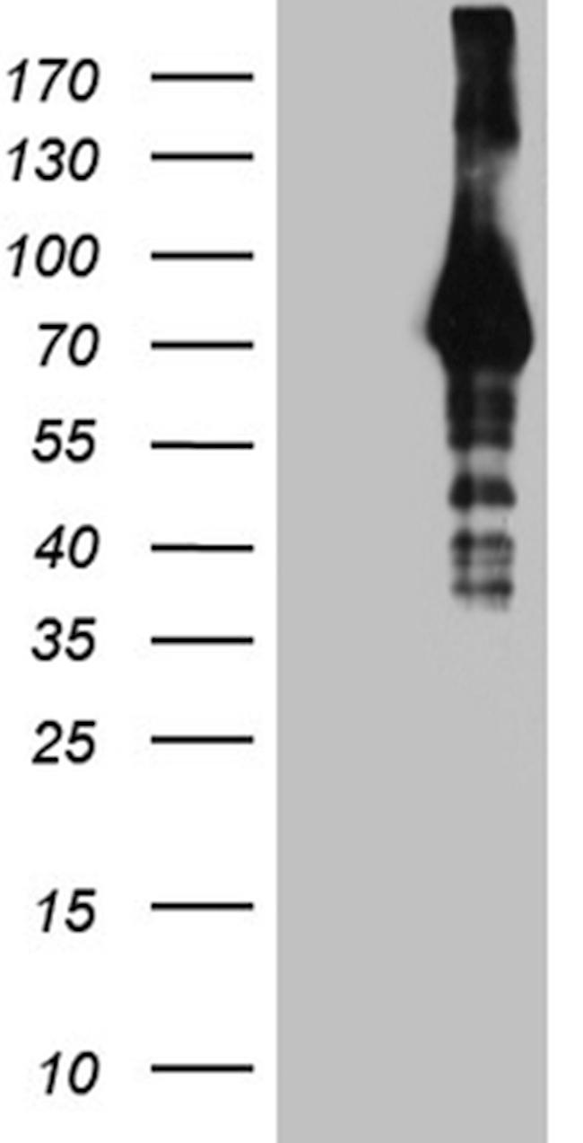 HABP2 Antibody in Western Blot (WB)