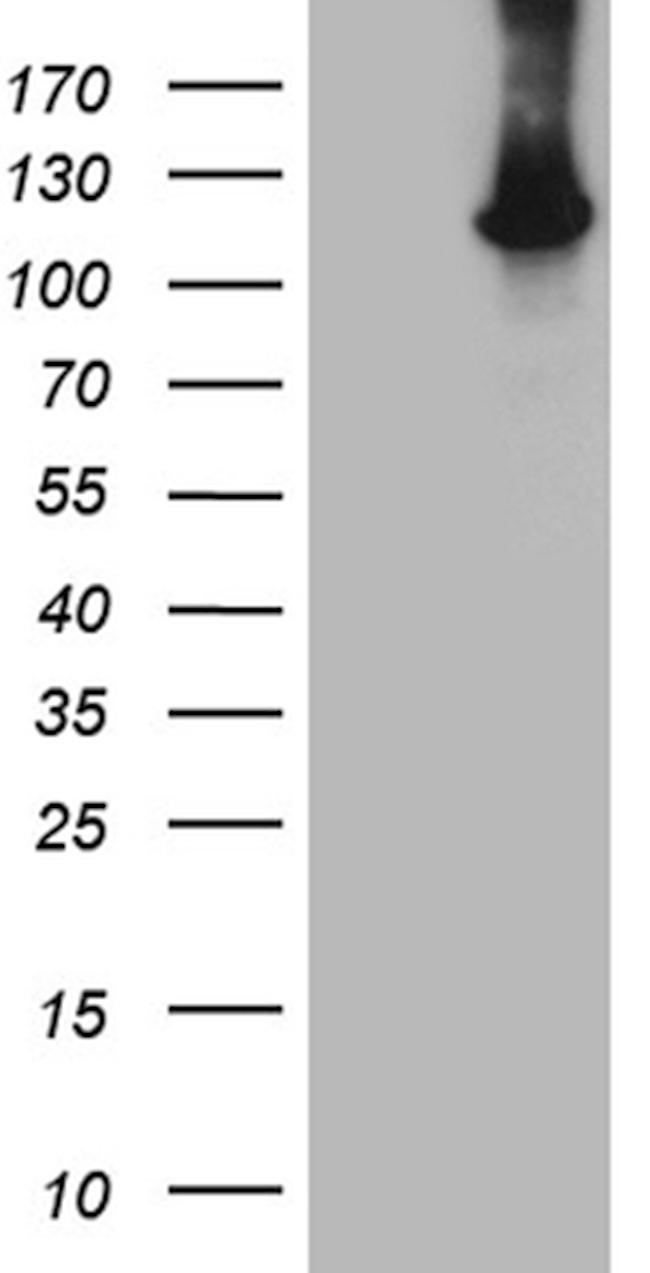 HACE1 Antibody in Western Blot (WB)