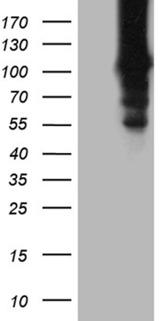 HACE1 Antibody in Western Blot (WB)