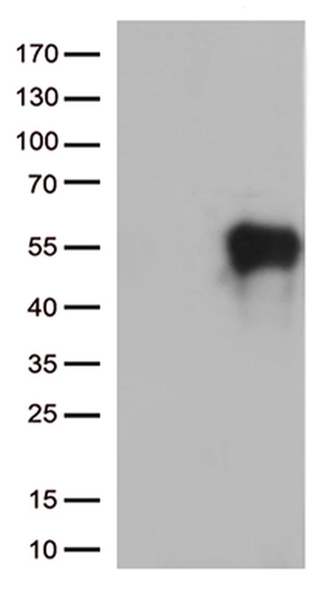 HAVCR2 Antibody in Western Blot (WB)