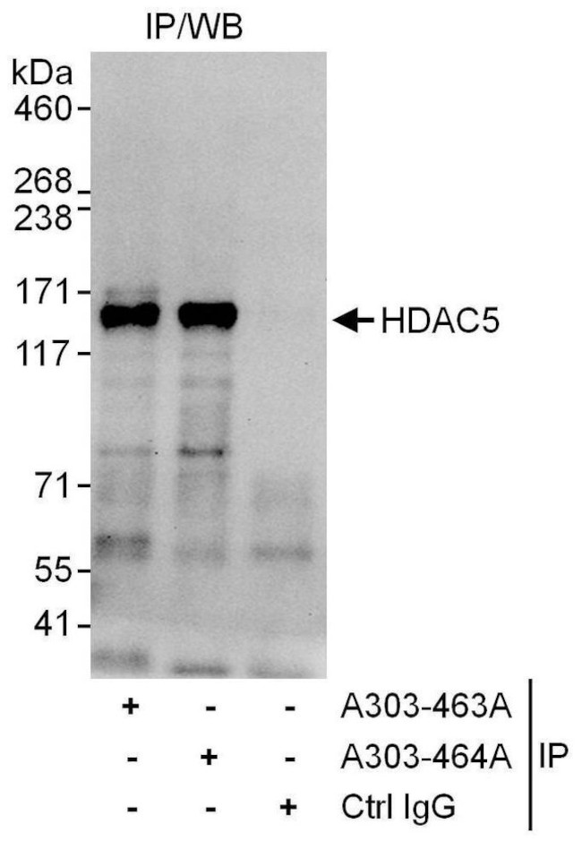 HDAC5 Antibody in Immunoprecipitation (IP)