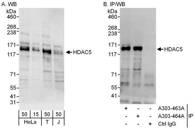 HDAC5 Antibody in Western Blot (WB)