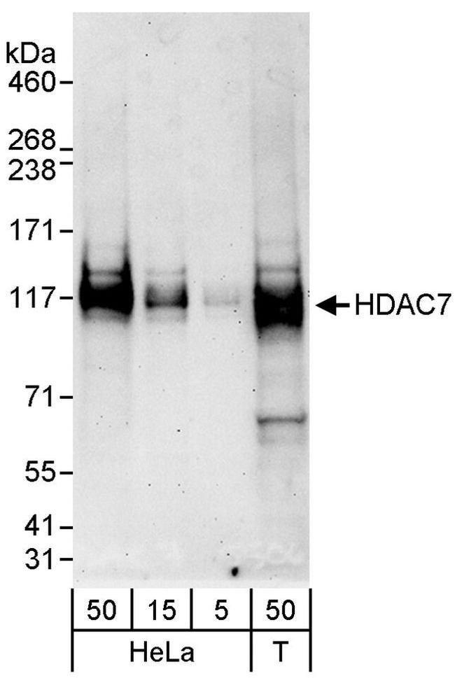 HDAC7 Antibody in Western Blot (WB)