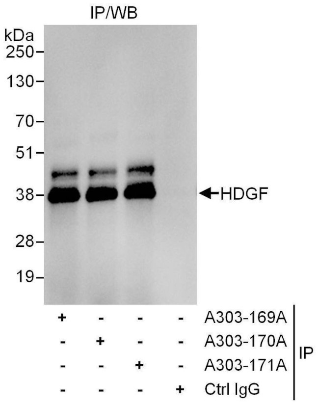 HDGF Antibody in Immunoprecipitation (IP)