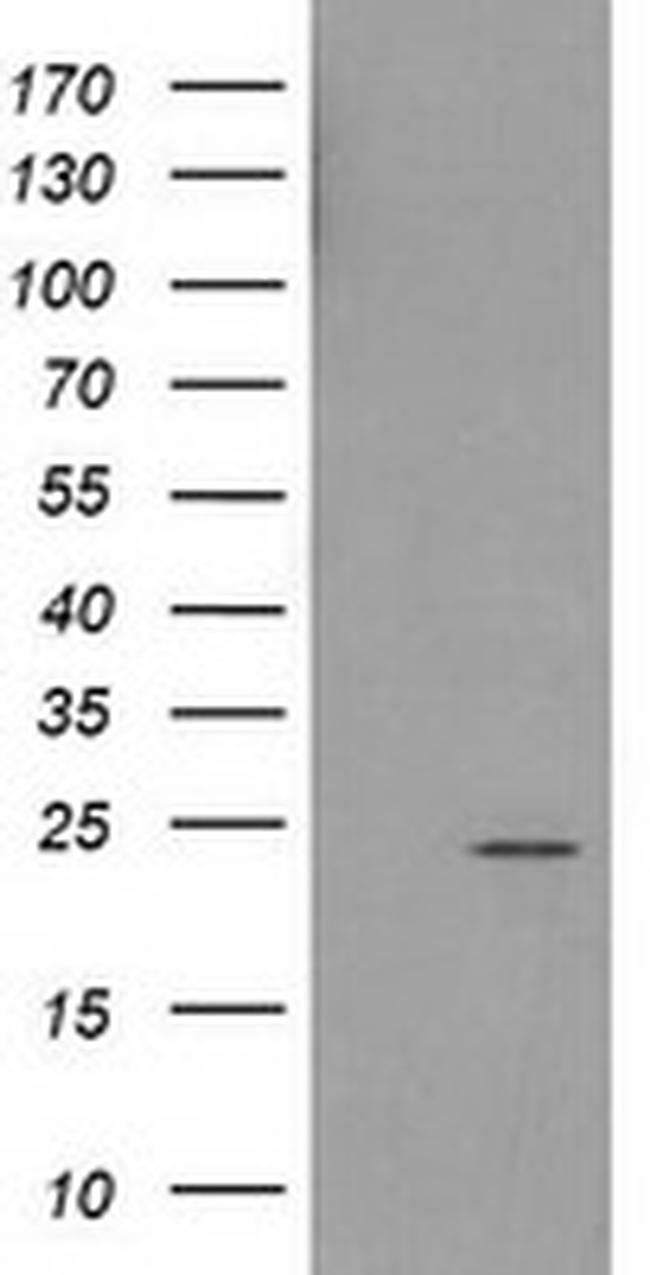 HDHD1 Antibody in Western Blot (WB)