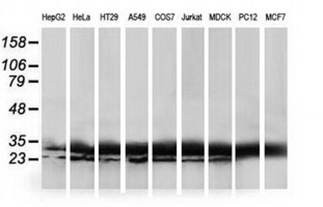 HDHD1 Antibody in Western Blot (WB)