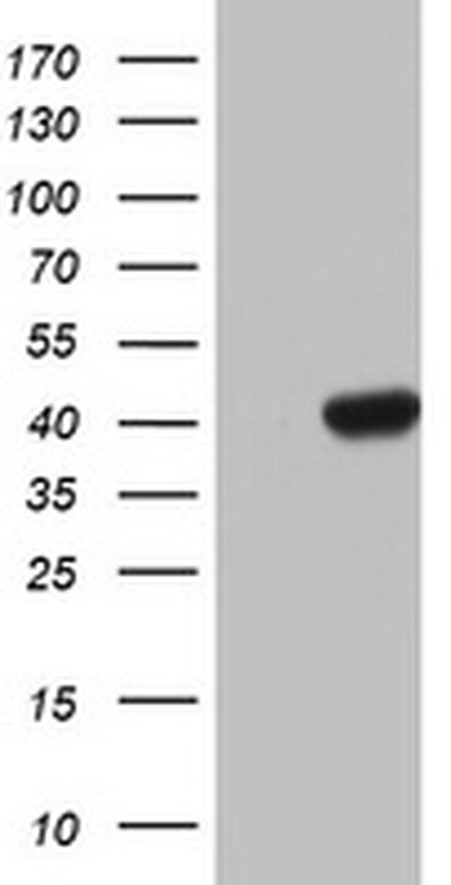 HMBS Antibody in Western Blot (WB)