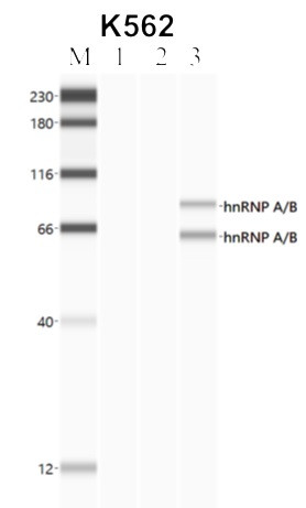 hnRNP AB Antibody in Immunoprecipitation (IP)