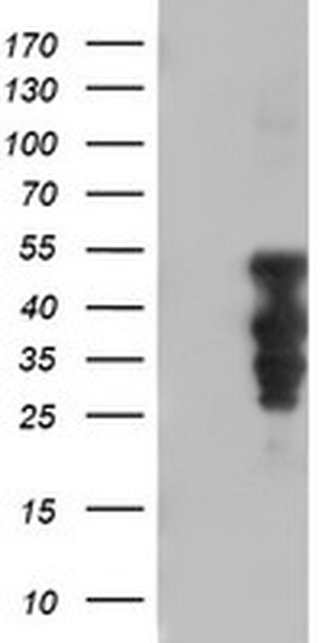HOXC11 Antibody in Western Blot (WB)