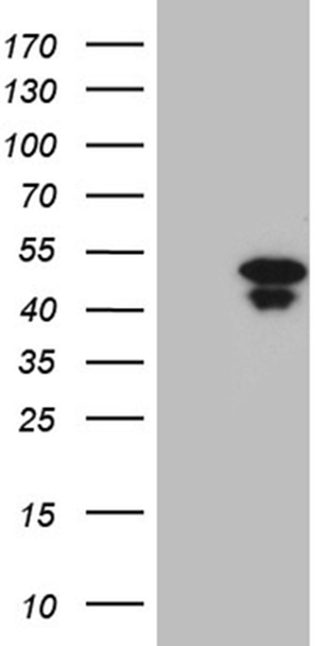 HOXD9 Antibody in Western Blot (WB)